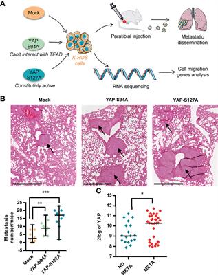Involvement of the TGF-β Signaling Pathway in the Development of YAP-Driven Osteosarcoma Lung Metastasis